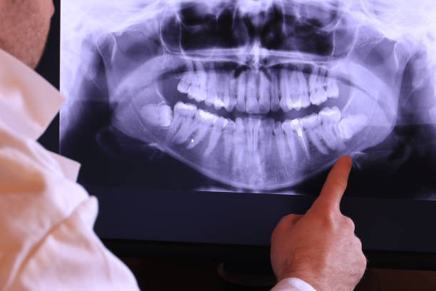 Best Broken or Cracked Tooth Emergency Dentist in Hartsville, TN